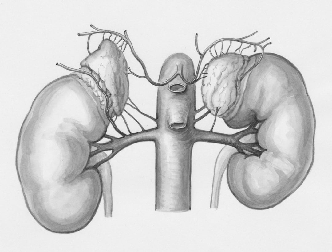 #Nyrekræft eller #cancer renis, illustreret ved sort-hvid skitse af nyrer.