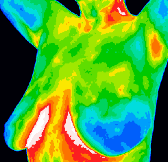 Termografi symboliseret ved termografisk billede af øvre del af torso - brystparti