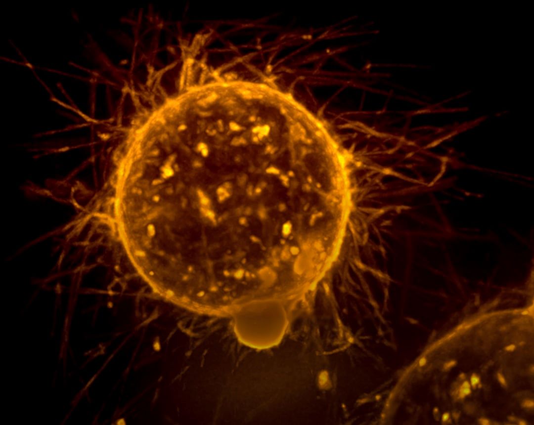 HRD-mutation symboliseret ved en rund orange celleagtig form med ujævn overflade på sort baggrund.