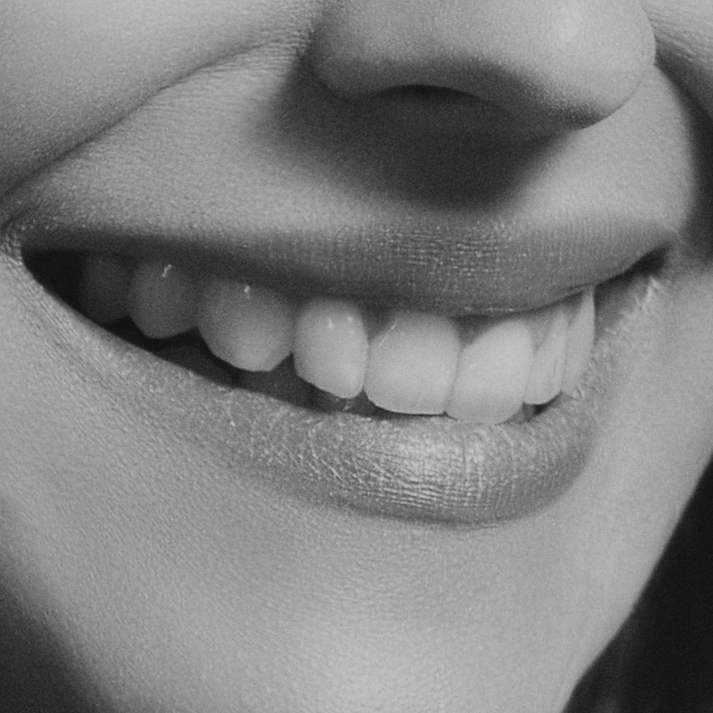 Tandproblemer symboliseret ved nærbillede af smil der blotter tænderne på en kvinde.