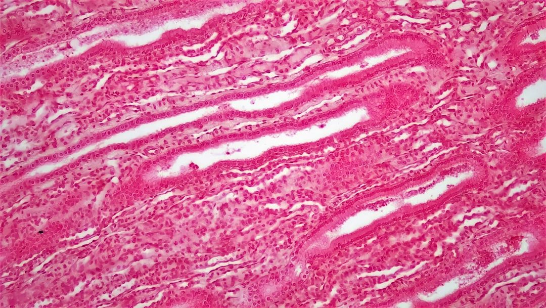 Embolisering symboliseret ved nærbillede af en rødmarmoreret overflade.