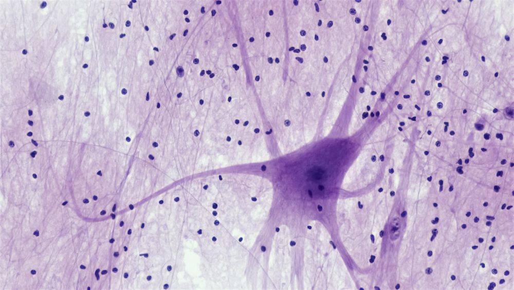 Neuroendokrine tumorer – symptomer og behandling