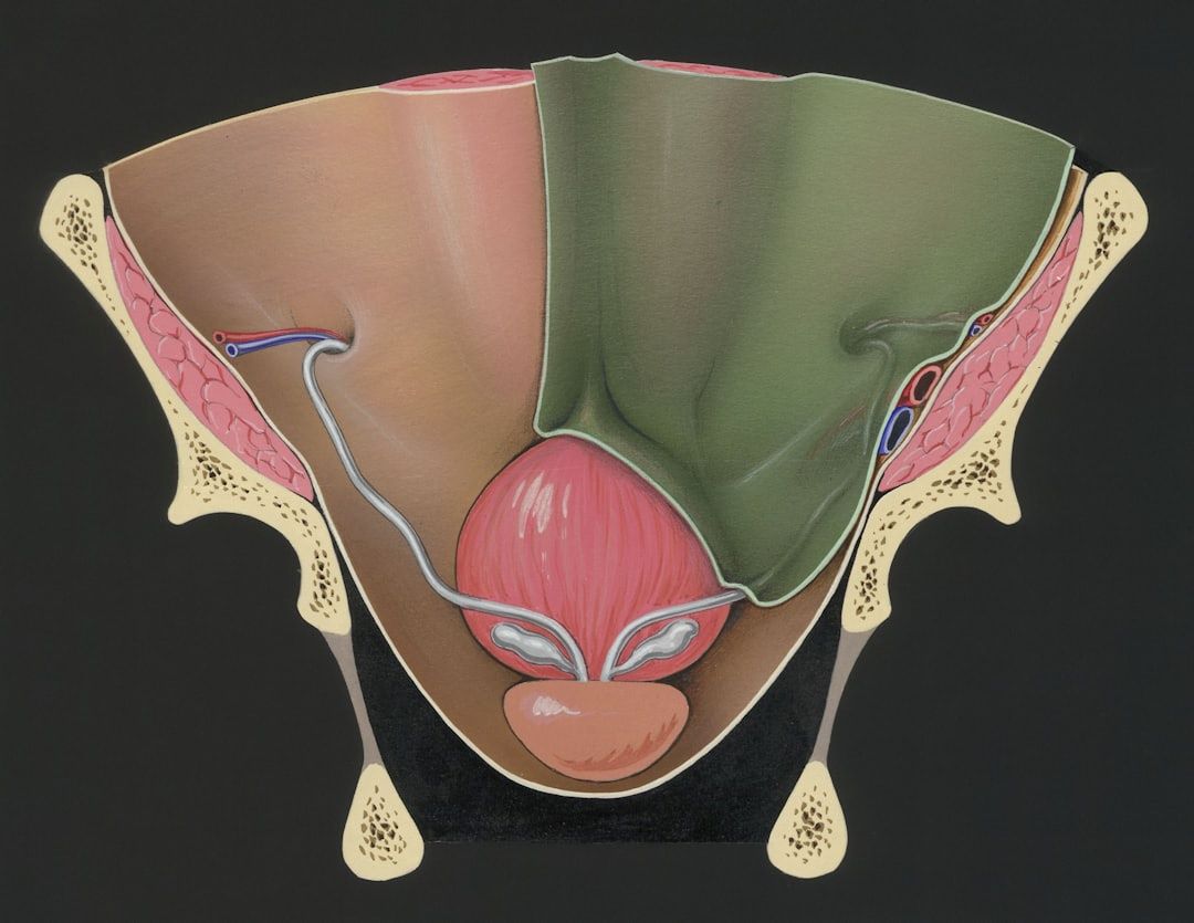 Prostata symboliseret ved skematisk modeltegning af snit i bækken ved prostata.
