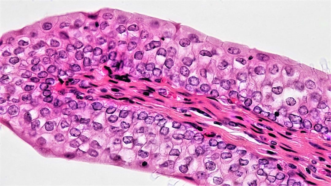 IDH1-mutation symboliseret ved langstrakt rosa-lilla farvet celleagtig struktur på hvid baggrund.