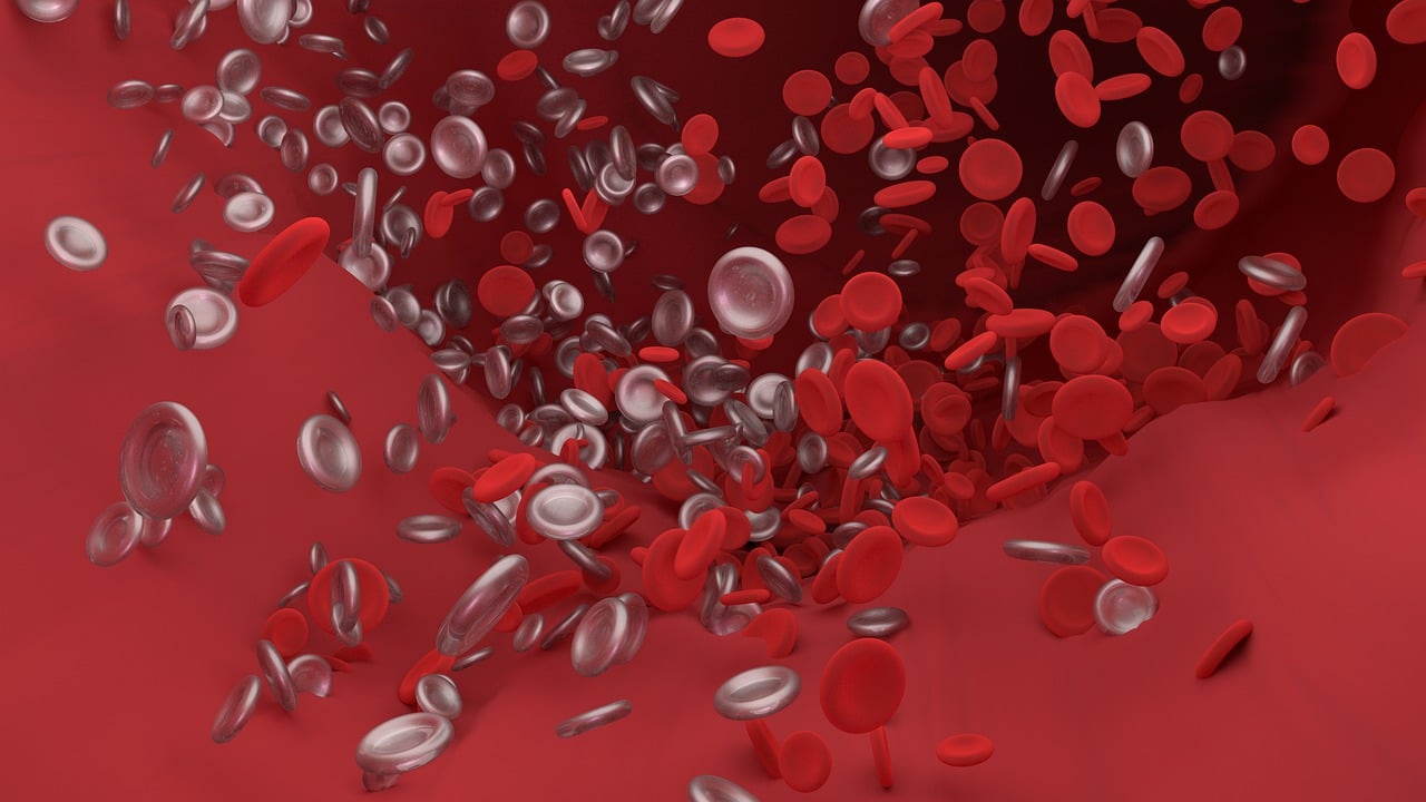 Blodpropper ved kræft. Emboli. Hjerneslag. Slagtilfælde. Stroke. Hjerteanfald. Hjertestop. Trombose. Blodpropper i benene. Blodprop i lungen. Symptomer på blodprop. Tegn på blodprop. Forebyggelse af blodprop. Behandling af blodprop. Efter en blodprop. Pludselig blodprop. Dyb venetrombose. Åreforkalkning.