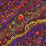 Metaboliske principper. Her er endnu et billede, der viser kræftceller i interaktion med tumormikromiljøet