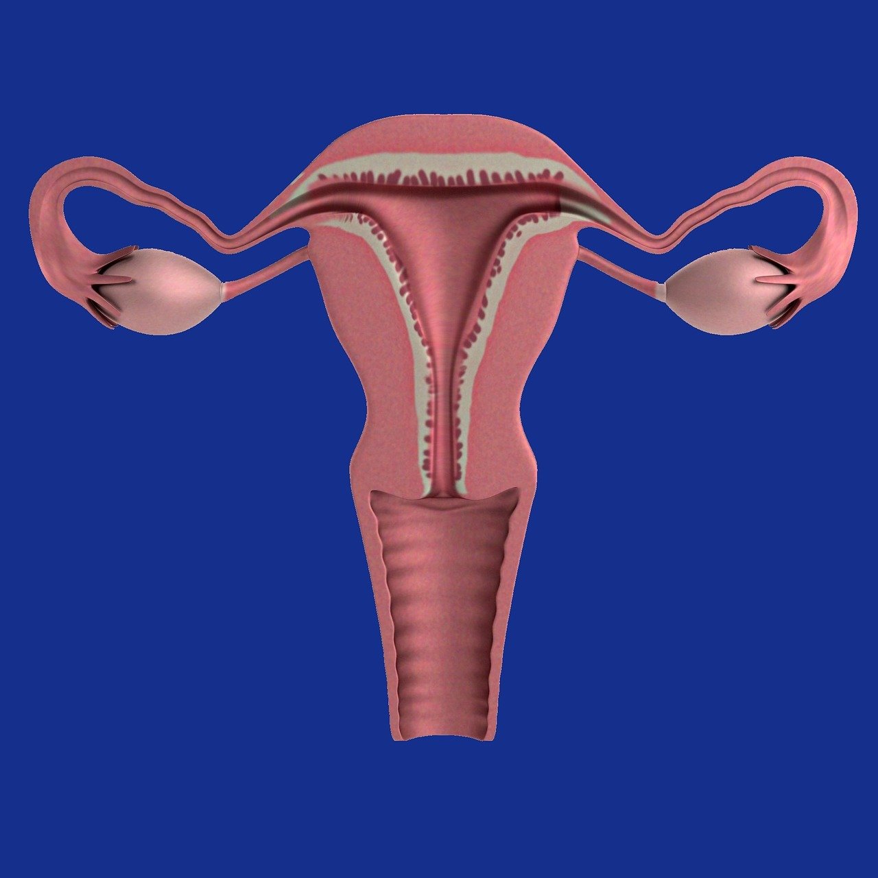 Gynækologiske kræftformer – Metaboliske tilgange til kræftbehandling ved Ovariecancer, Æggestokkræft, Livmoderkræft, Livmoderhalskræft, Vaginal kræft.