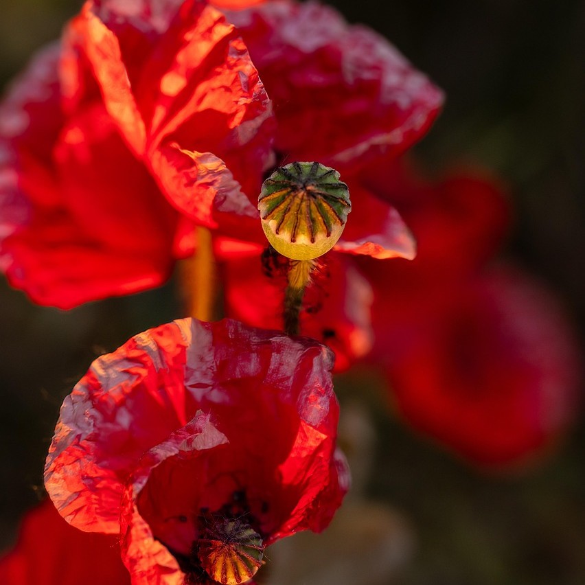 Biskjoldbruskkirtelkræft. Biskjoldbruskkirtelkræft. Parathyreoideakræft. Kræft i biskjoldbruskkirtlen. Hyperparathyroidisme kræft. Højt PTH og kræft. Hypercalcæmi kræft.