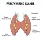 Biskjoldbruskkirtelkræft symboliseret ved en tegning af skjoldbruskkirtlen, med synlige hvide bønneagtige figurer, der angiver biskjoldbruskkirtlen.