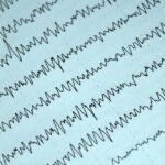EEG, Elektroencefalografi symboliseret ved en masse grafi-streger fra et måleapparat.
