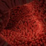 Endetarmskræft symboliseret ved et indre af noget tarmlignende med små villi. Røde toner.