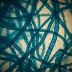 Spirulina symboliseret ved mikroskopifoto af spirulina-alger.