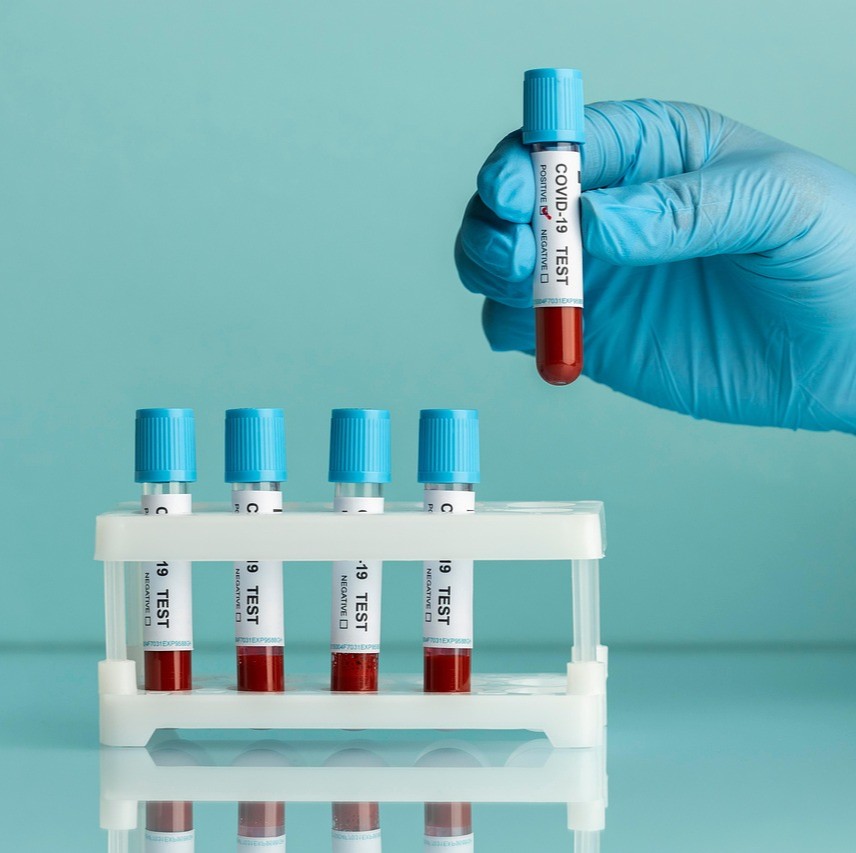 Tumormarkører symboliseret ved et stativ til blodprøver. Der står 4 i dette og en behandsket hånd er ved at sætte det femte.