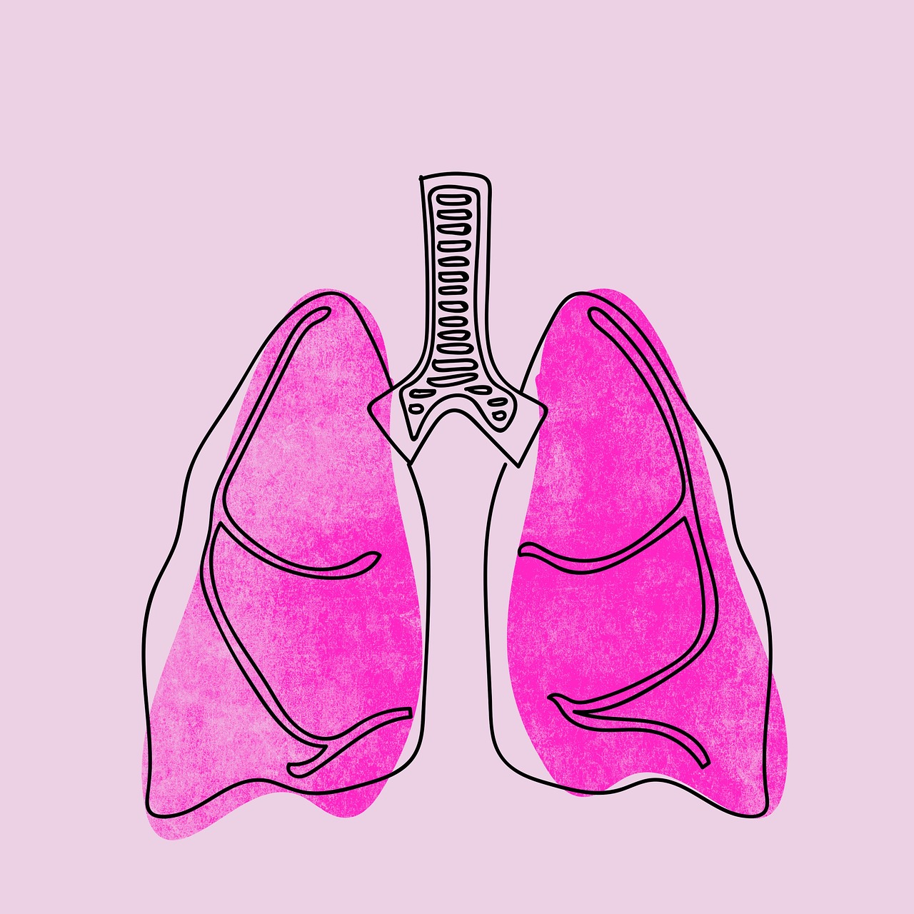 Lungehindekræft – Metaboliske tilgange til kræftbehandling. Kræft i lungehinderne. Bloker lungehindekræfts pathways.