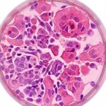 Beljanski Protokollen symboliseret ved en petriskål med celler der er røde og lilla.